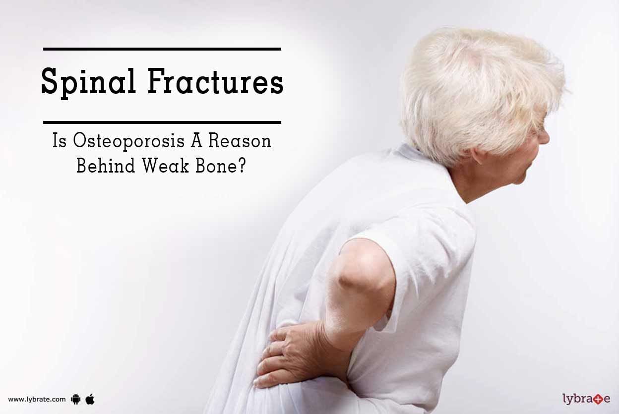 Spinal Fractures - Is Osteoporosis A Reason Behind Weak Bone?