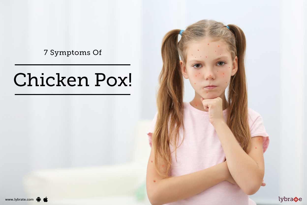 7 Symptoms Of Chicken Pox!