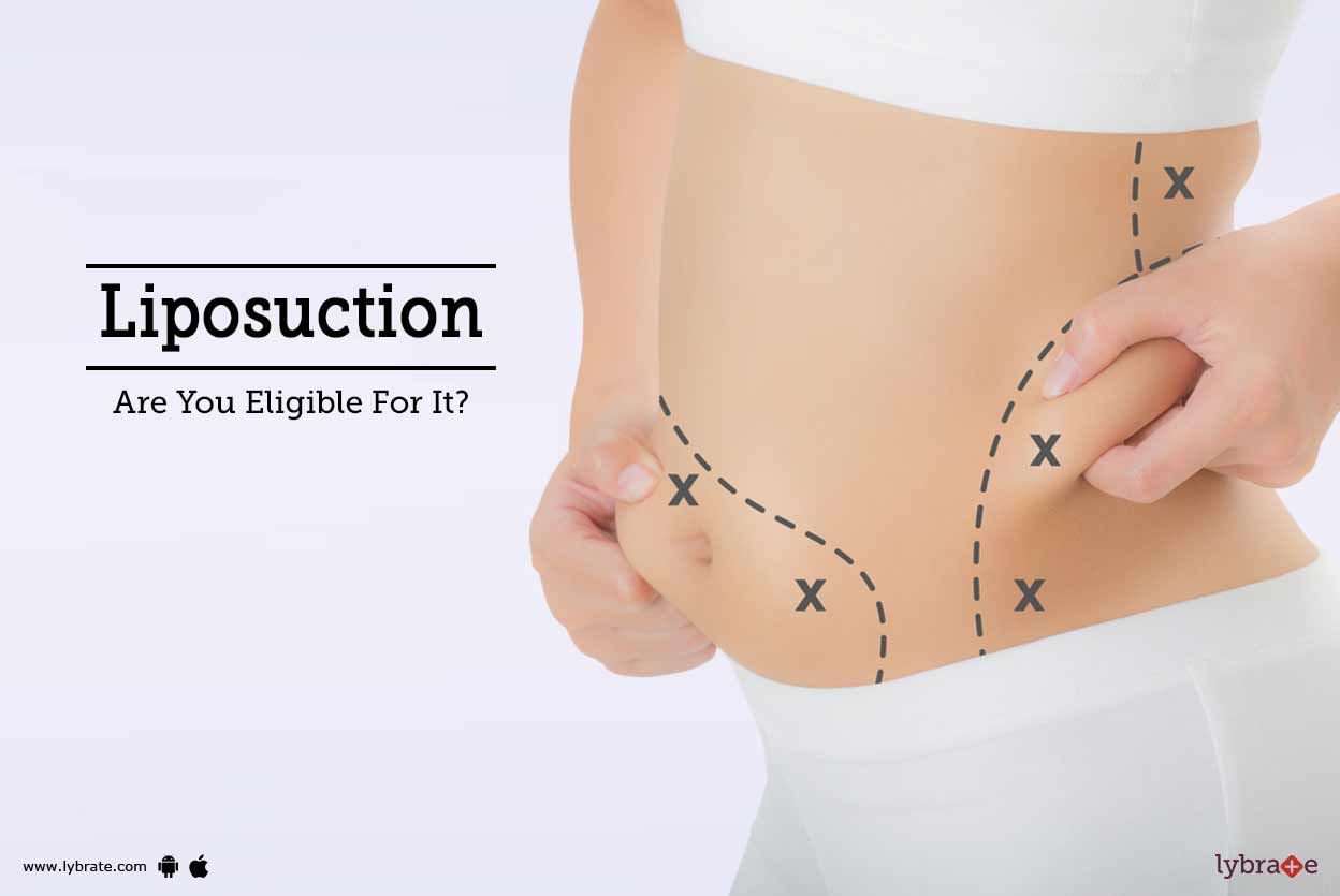 Liposuction - Are You Eligible For It?