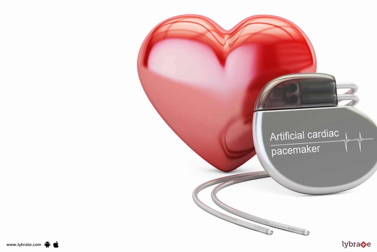 Heart Pacemaker - Know More About It!