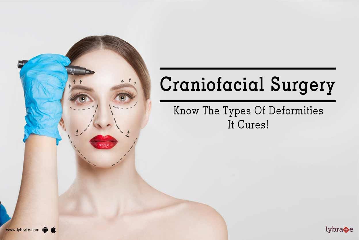 Craniofacial Surgery - Know The Types Of Deformities It Cures!