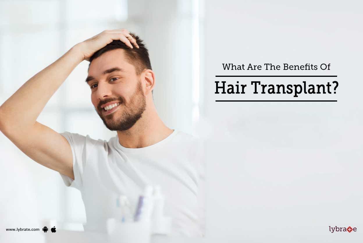 What Are The Benefits Of Hair Transplant?