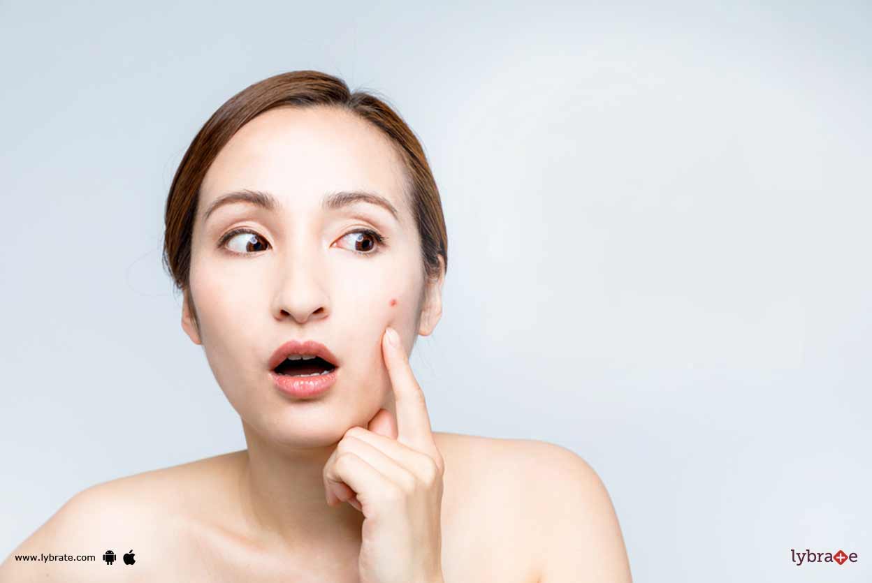 Vitamin B12 & Acne Is There A Link? By Dr. Sandesh Gupta Lybrate