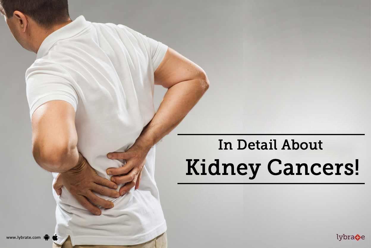 In Detail About Kidney Cancers!