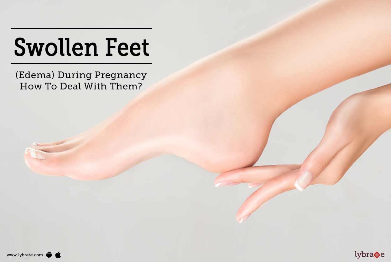 Swollen Feet (Edema) During Pregnancy - How To Deal With Them?