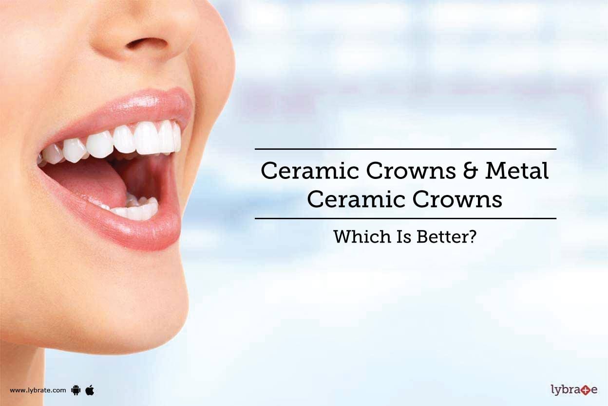 Ceramic Crowns & Metal Ceramic Crowns - Which Is Better?