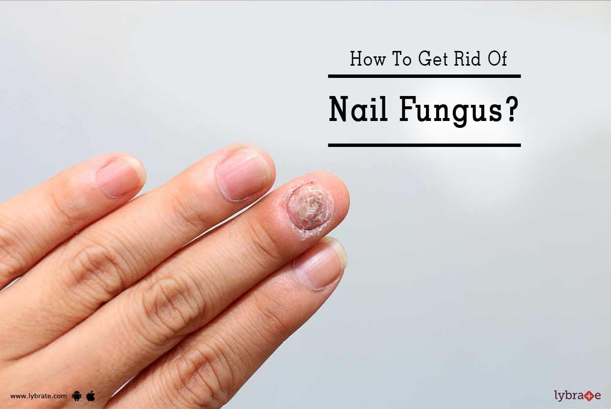 How To Get Rid Of Nail Fungus?