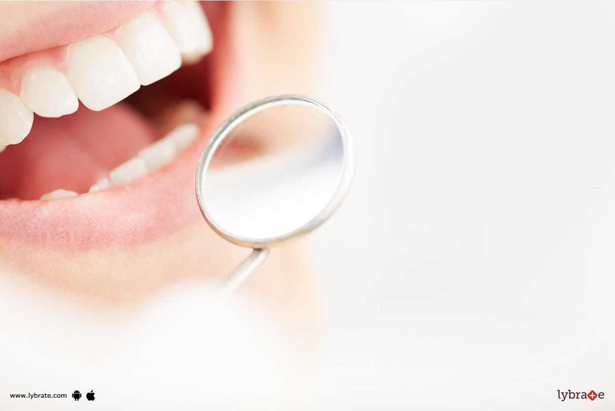 Dental Implants - Who Are Eligible For Them?