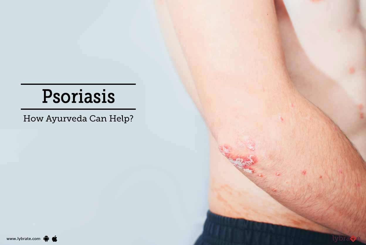 Psoriasis - How Ayurveda Can Help?