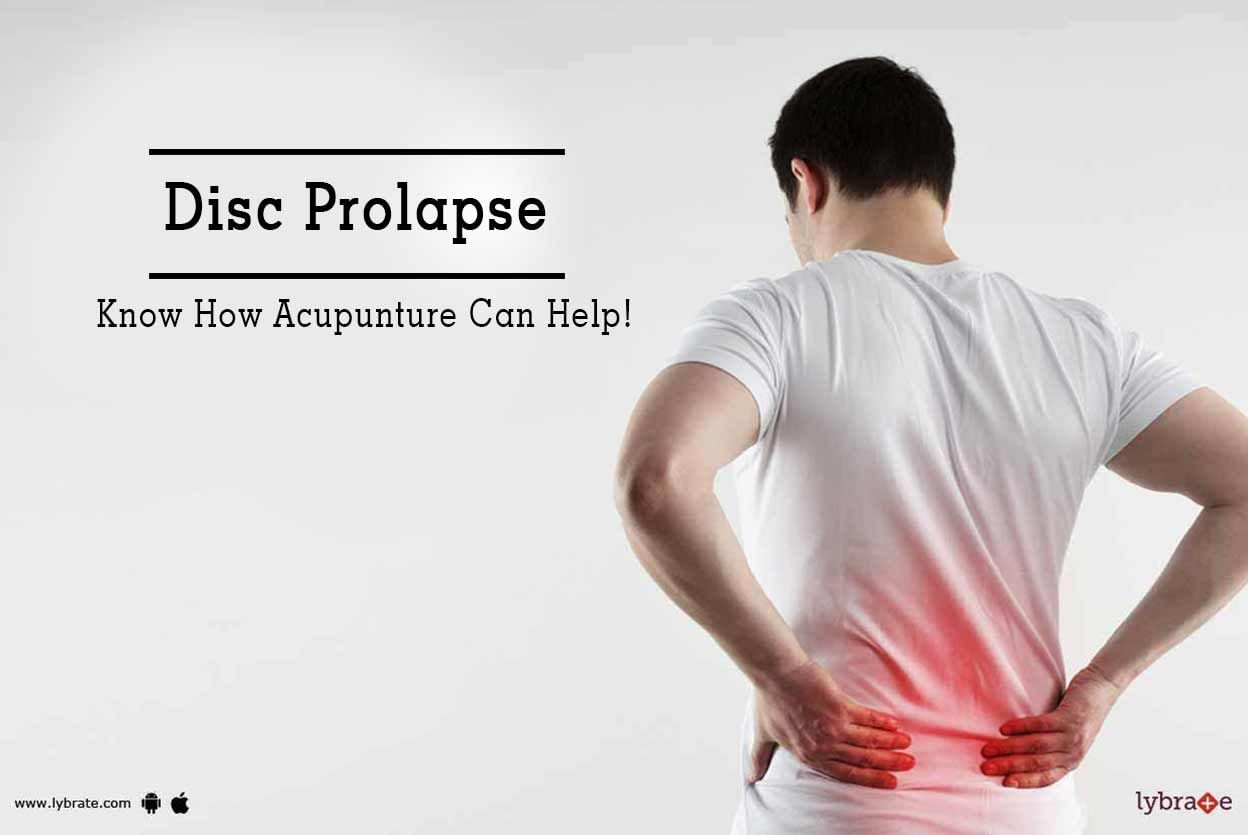 Disc Prolapse - Know How Acupunture Can Help!