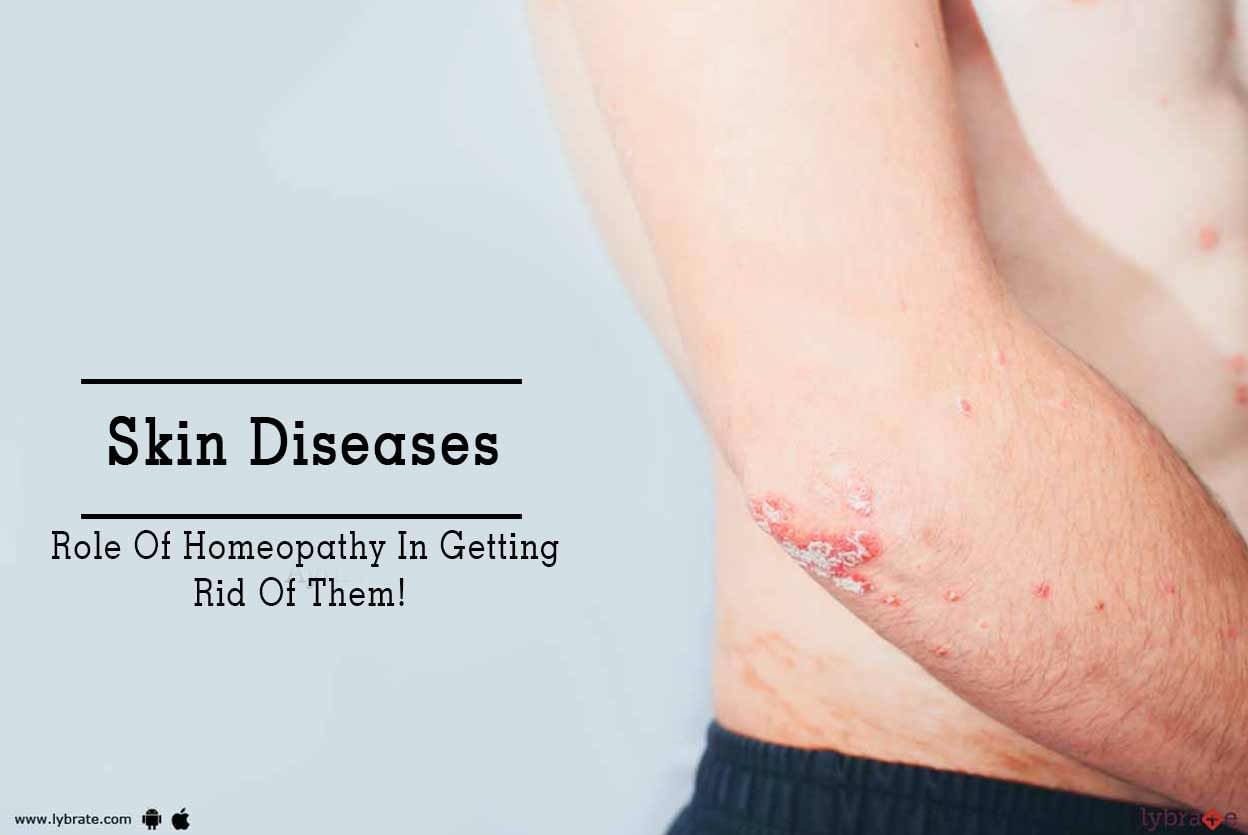Skin Diseases - Role Of Homeopathy In Getting Rid Of Them!