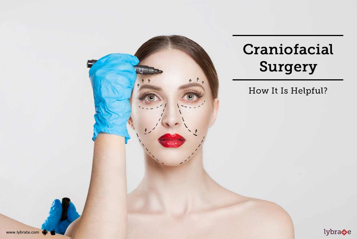 Craniofacial Surgery - How It Is Helpful?