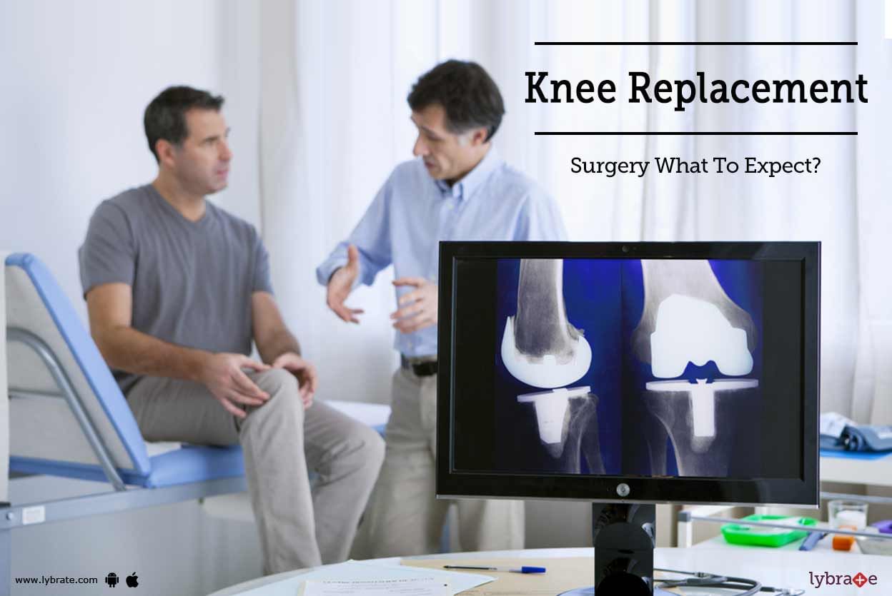 Knee Replacement Surgery - What To Expect?