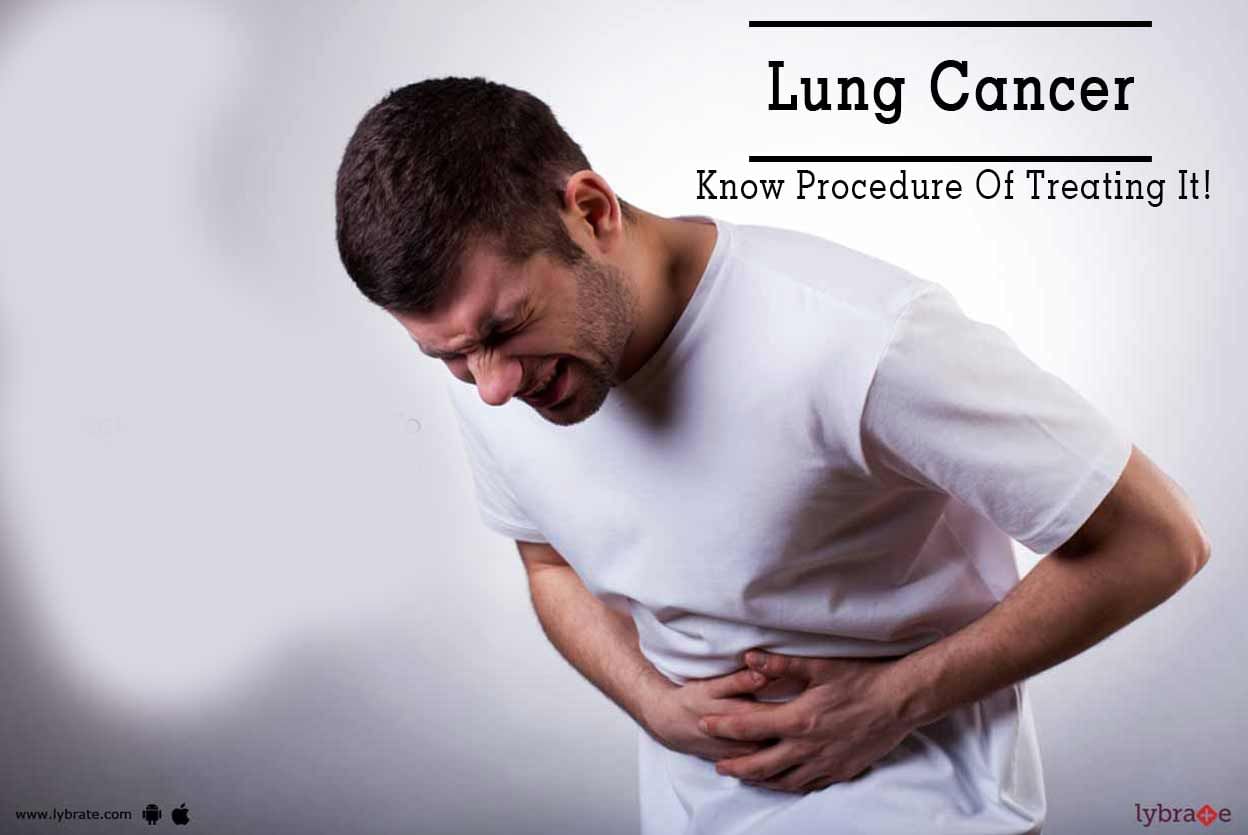Lung Cancer - Know Procedure Of Treating It!