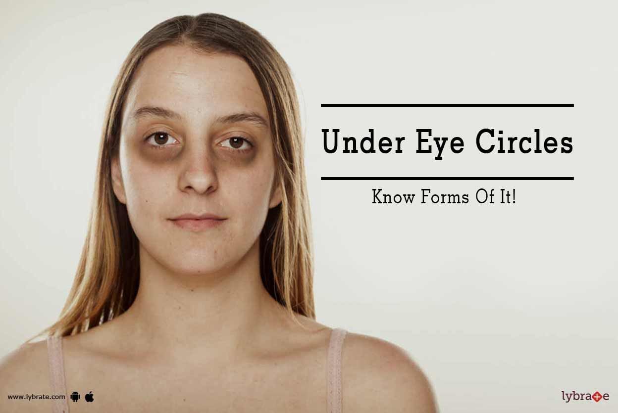 Under Eye Circles - Know Forms Of It!