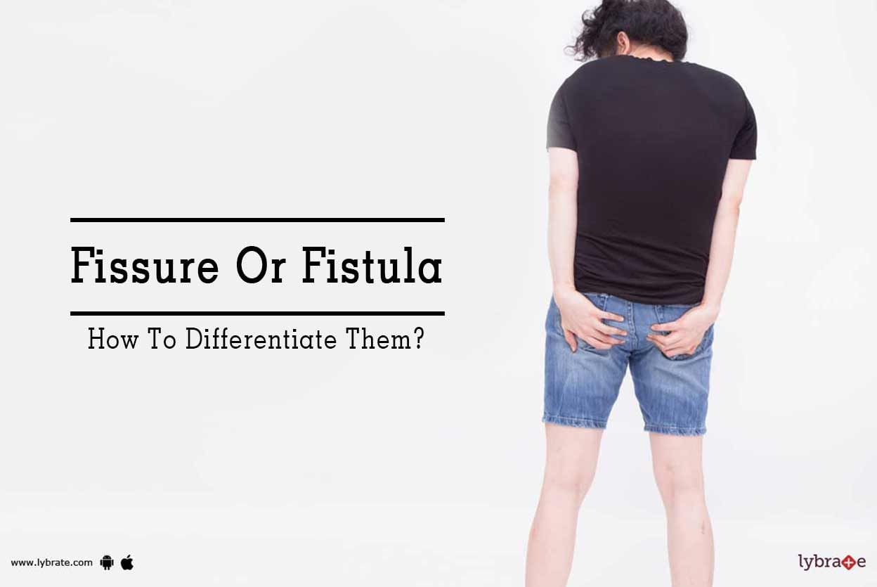 Fissure Or Fistula - How To Differentiate Them?