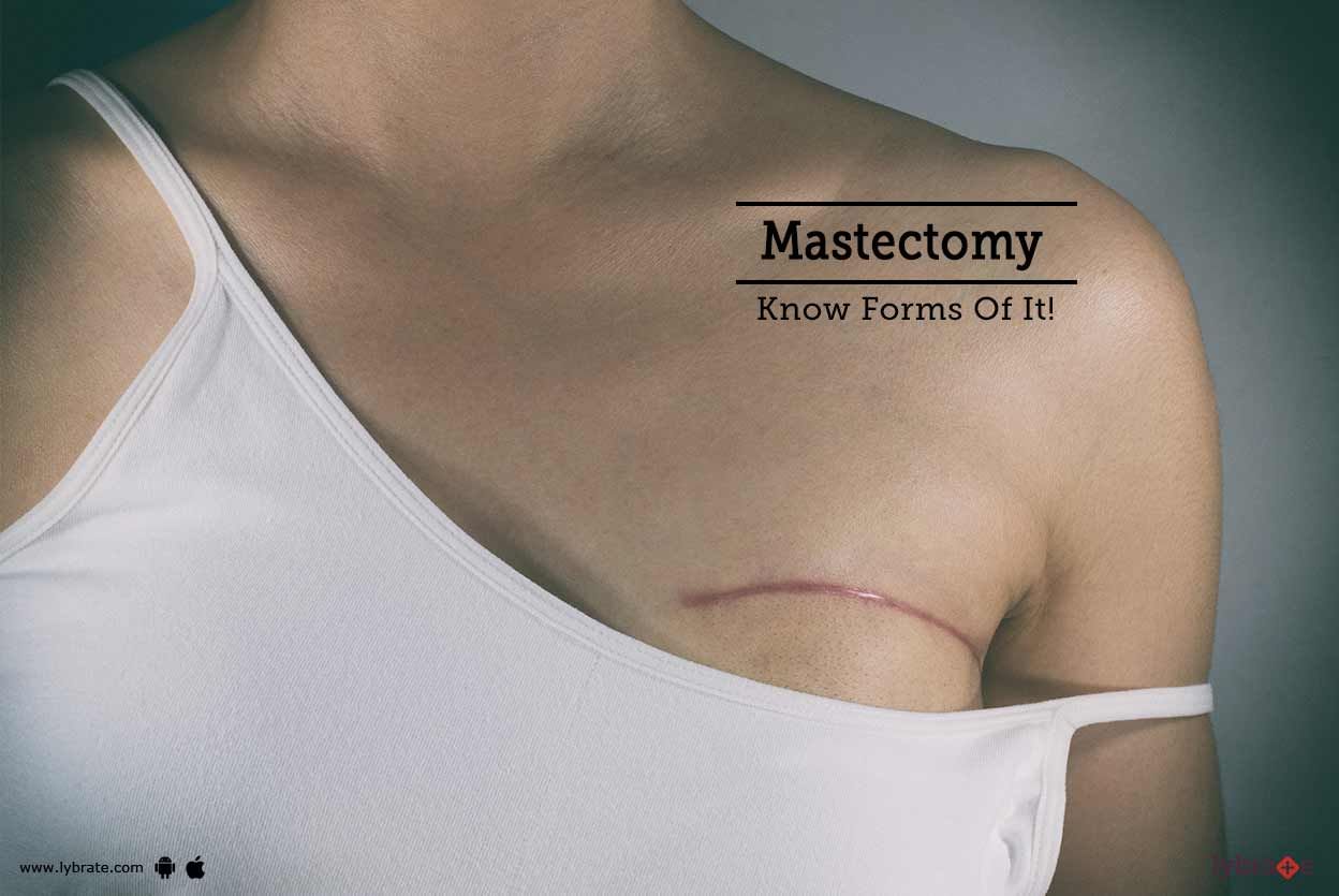 Mastectomy - Know Forms Of It!