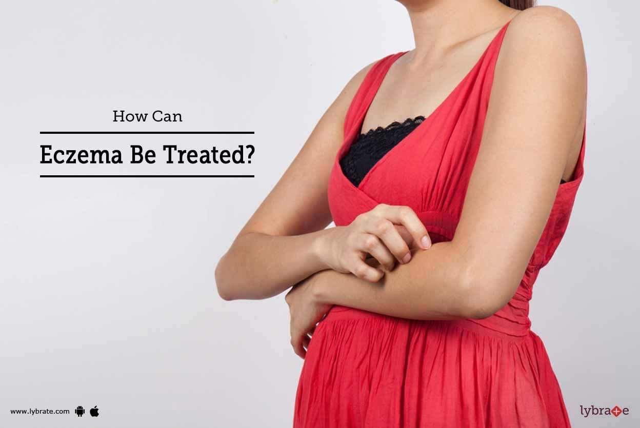 How Can Eczema Be Treated?