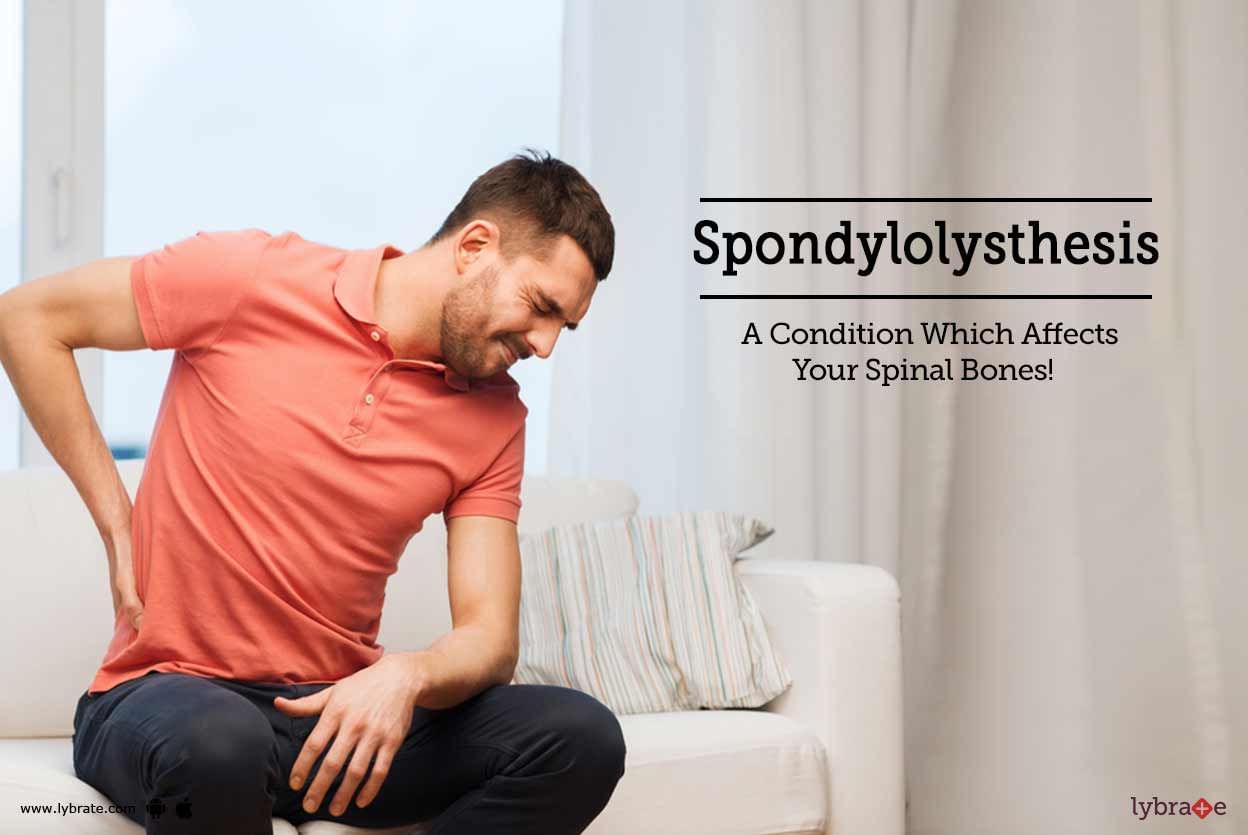 Spondylolysthesis - A Condition Which Affects Your Spinal Bones!