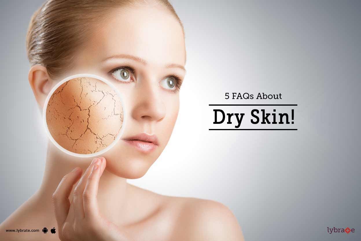 5 FAQs About Dry Skin!