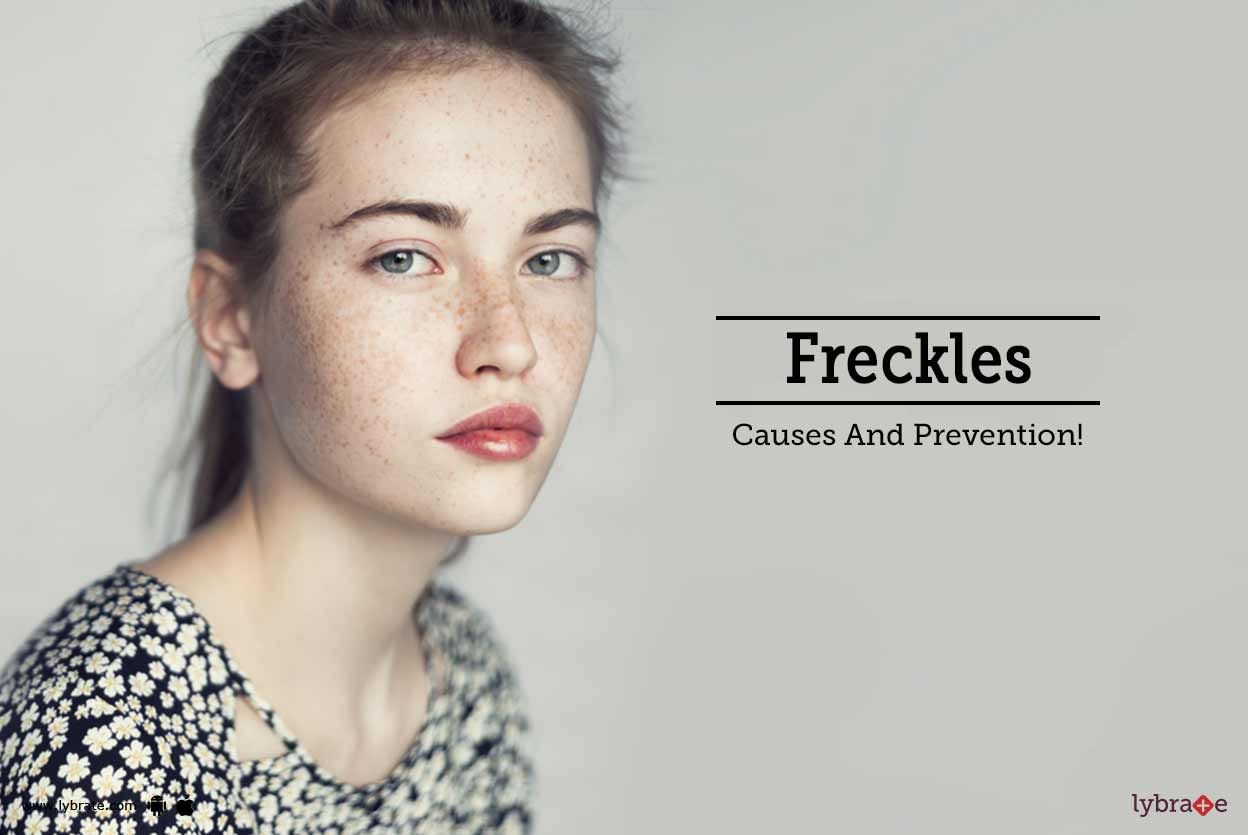 Freckles - Causes And Prevention!