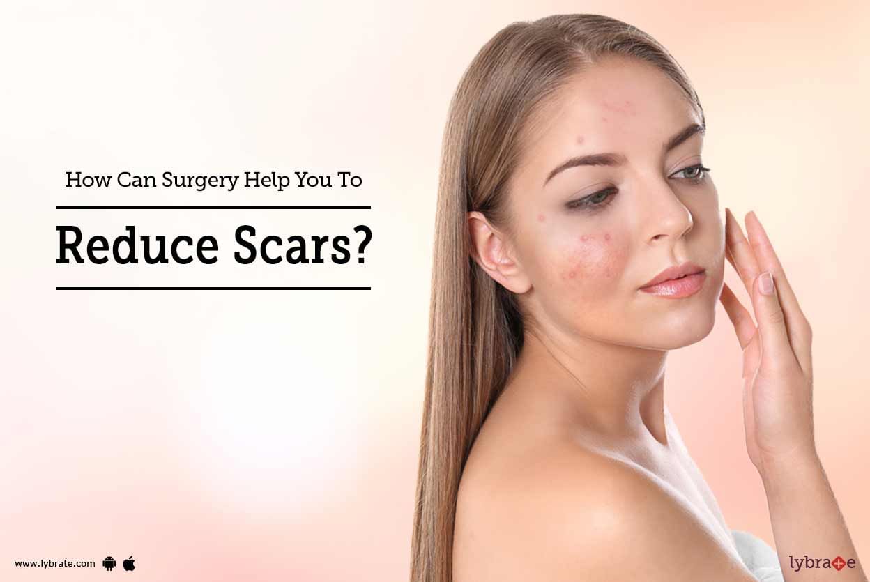 How Can Surgery Help You To Reduce Scars?