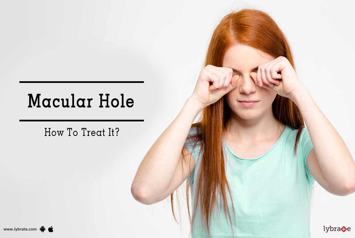 Macular Hole - How To Treat It?