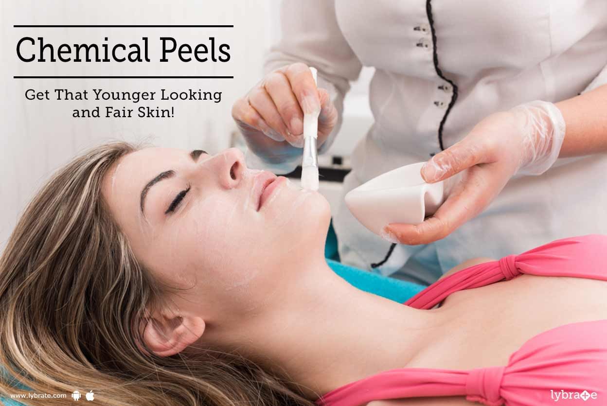 Chemical Peels - Get That Younger Looking and Fair Skin!