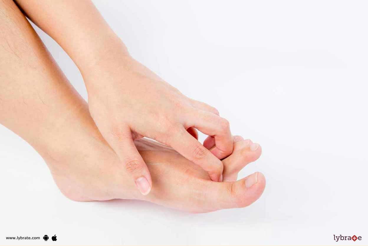 I Have Diabetes - Can I Develop A Charcot Foot?