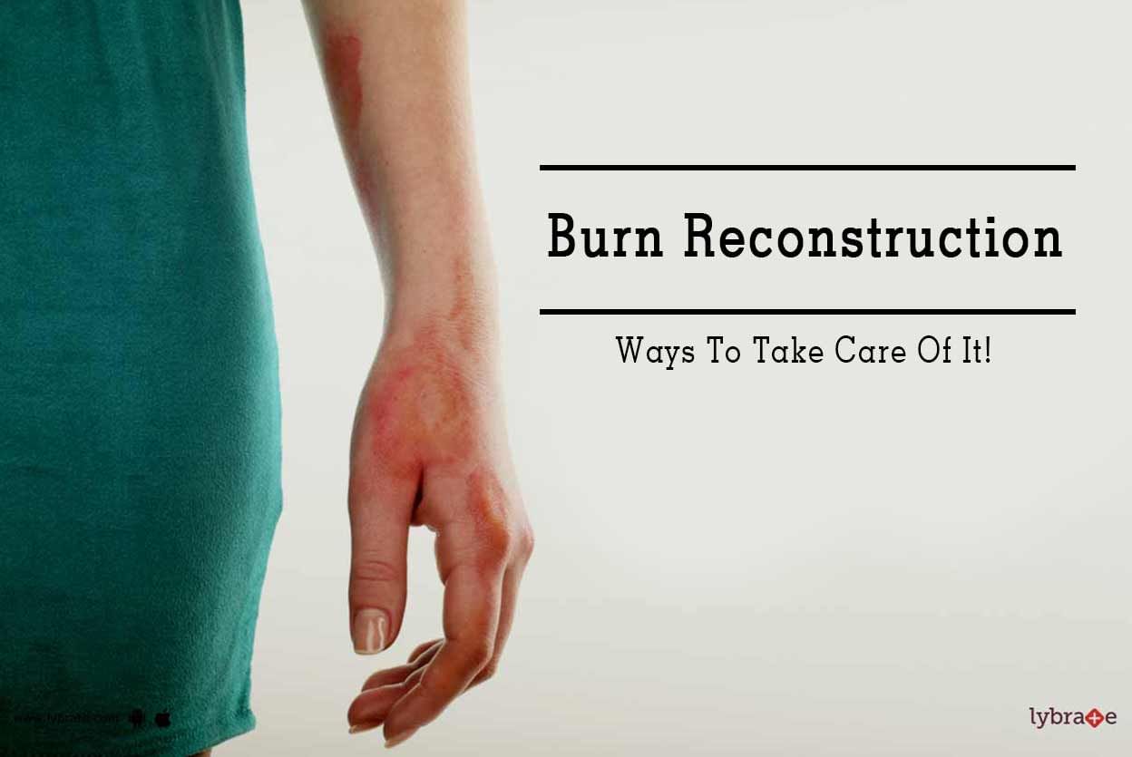 Burn Reconstruction - Ways To Take Care Of It!