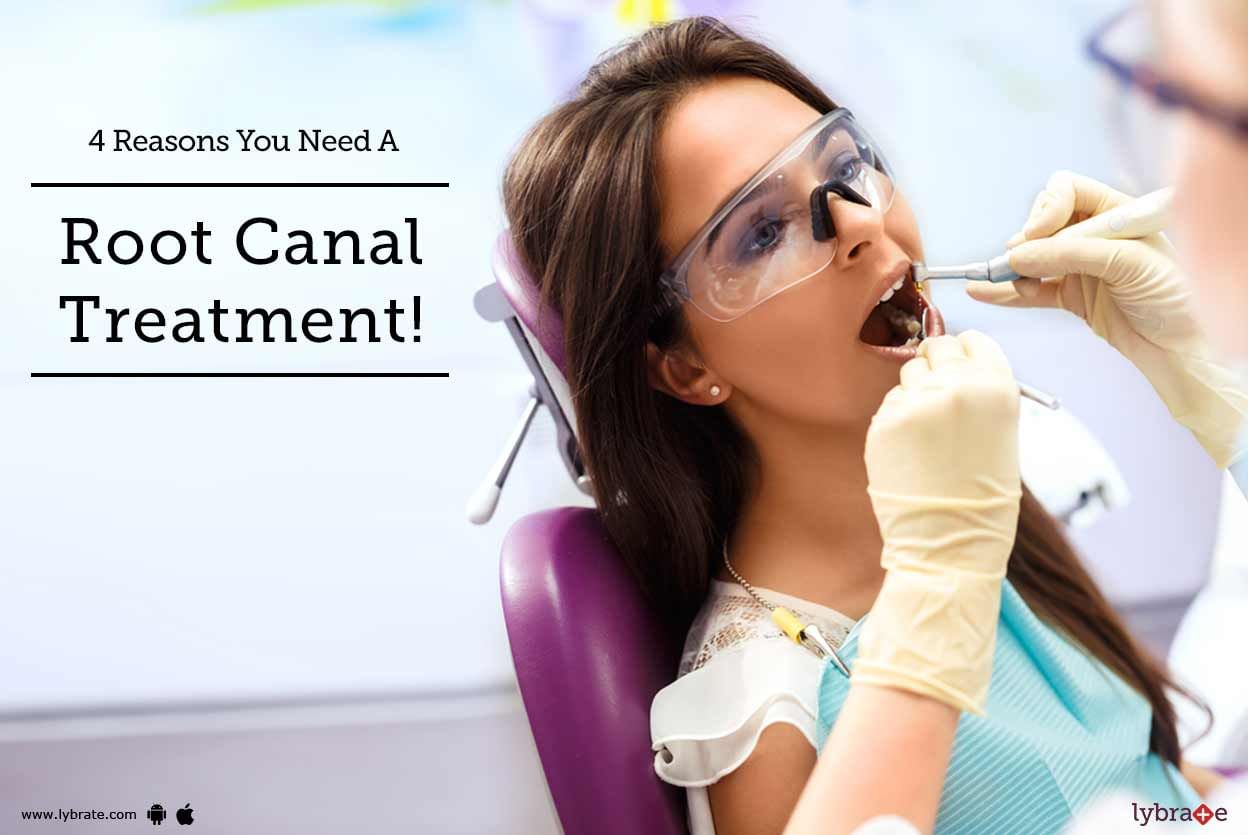 4 Reasons You Need A Root Canal Treatment!