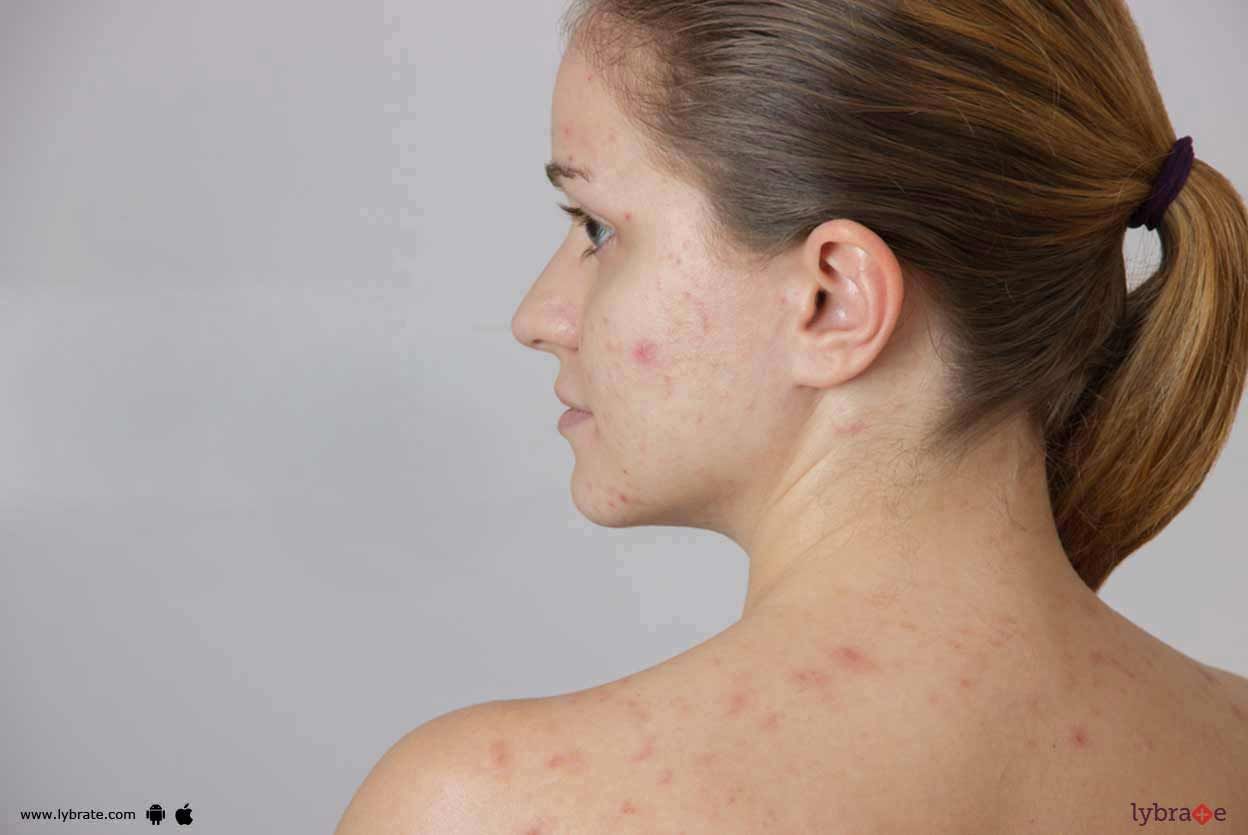 Skin Problems - How Can Homeopathy Handle Them?