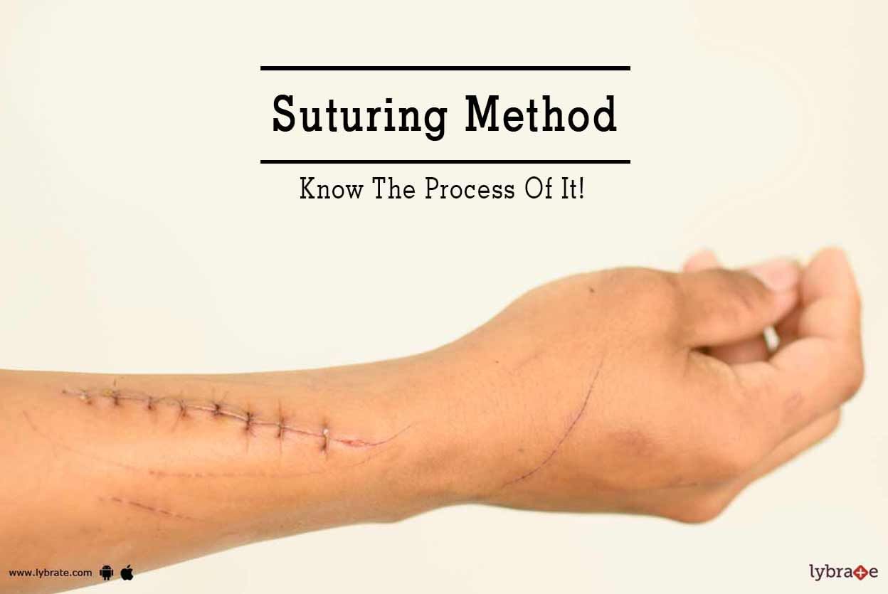 Suturing Method - Know The Process Of It!