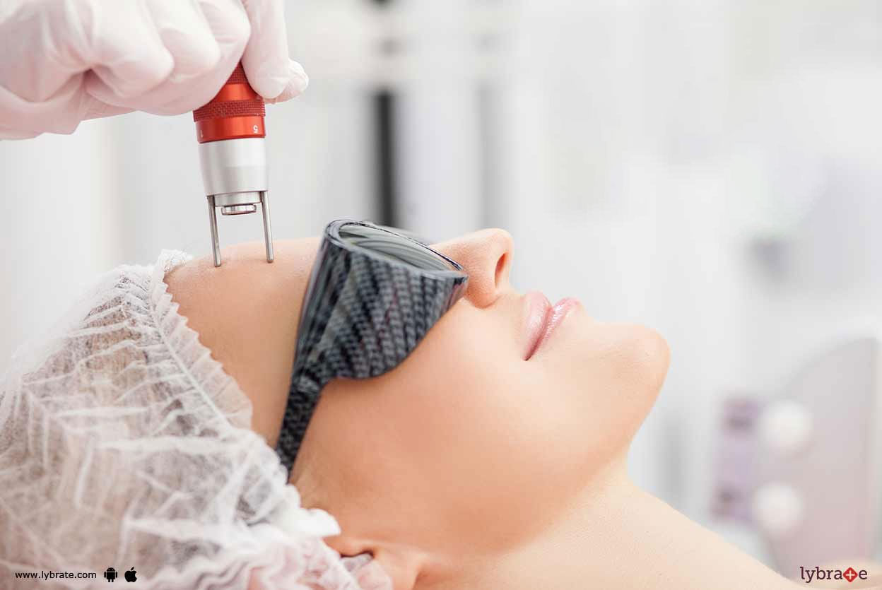 Know About Benefits Of Laser Skin Tightening Treatment!