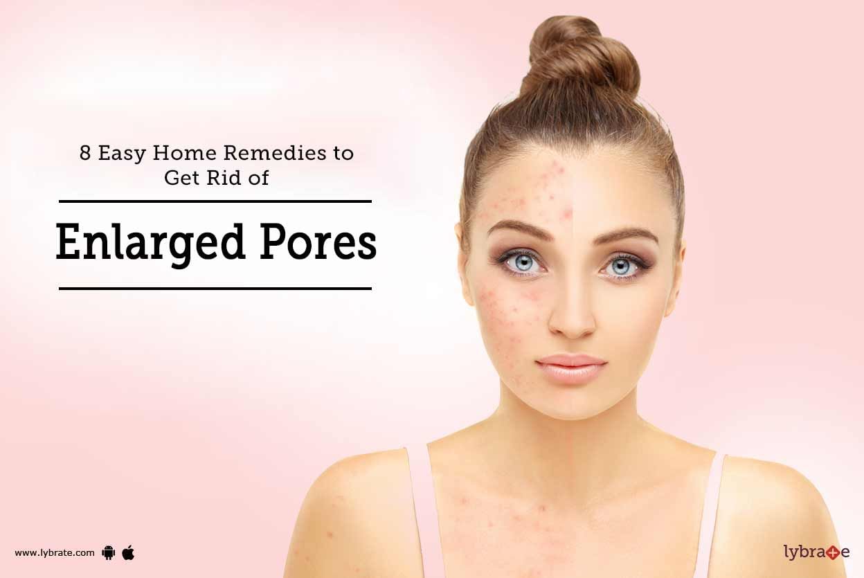 8 Easy Home Remedies to Get Rid of Enlarged Pores