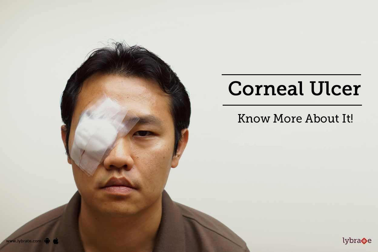 Corneal Ulcer - Know More About It!
