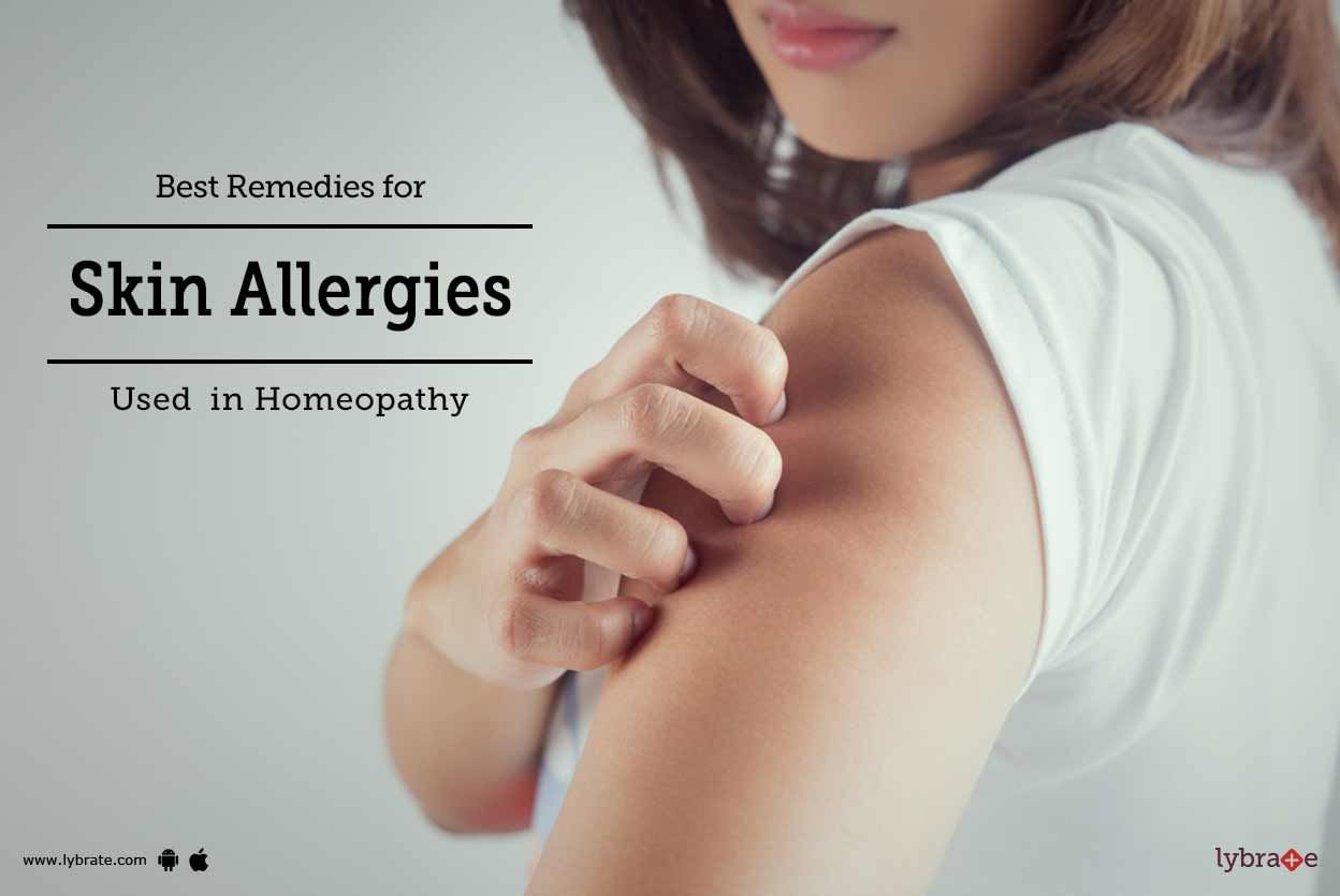 Best Remedies for Skin Allergies Used  in Homeopathy