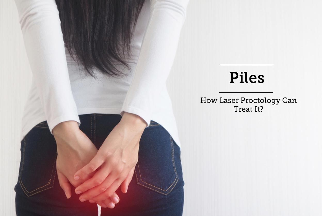 Piles - How Laser Proctology Can Treat It?