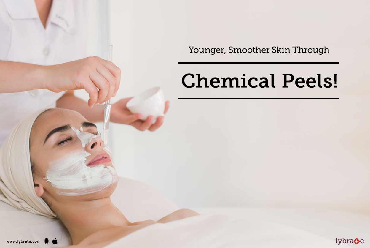 Younger, Smoother Skin Through Chemical Peels!