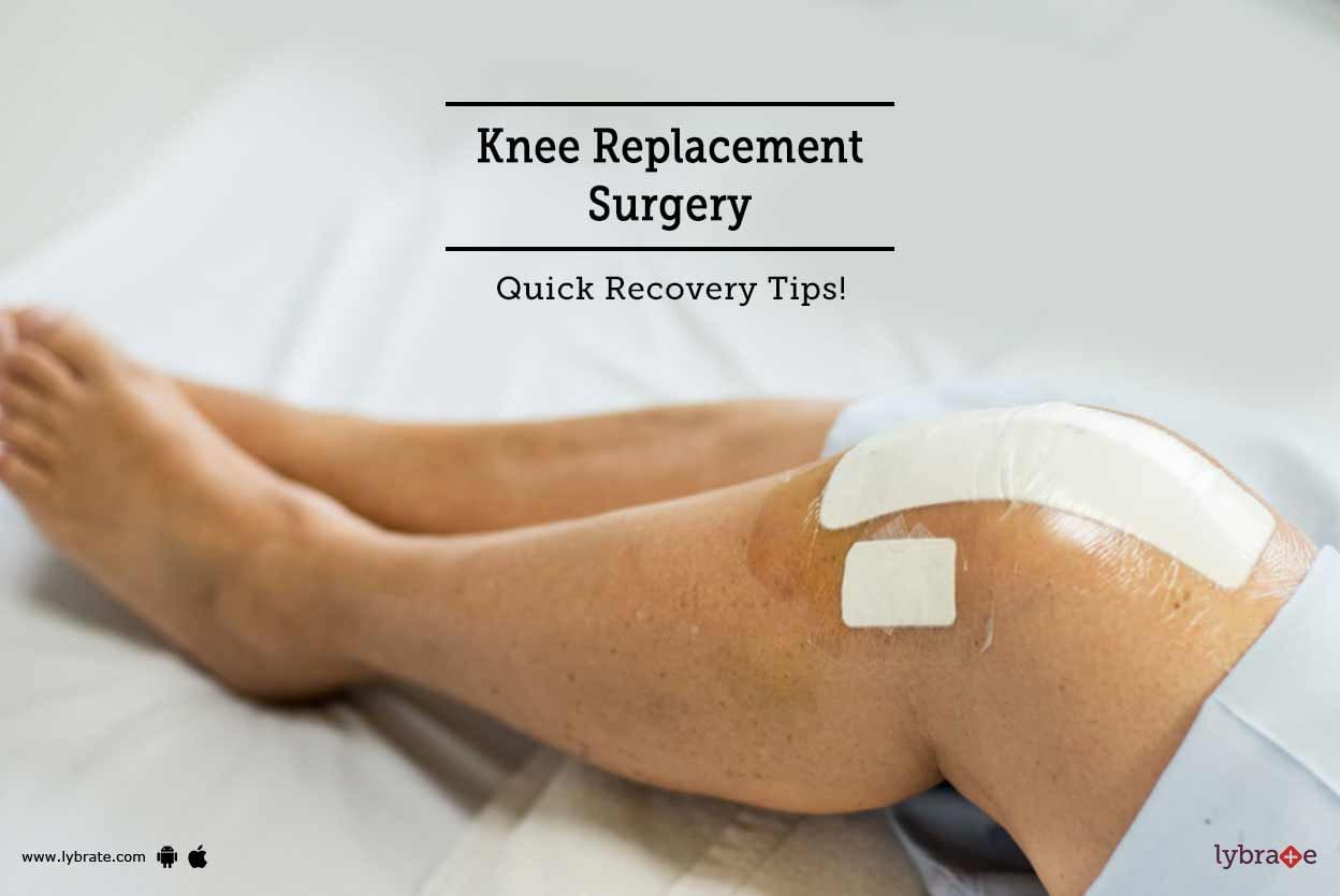 Knee Replacement Surgery - Quick Recovery Tips!