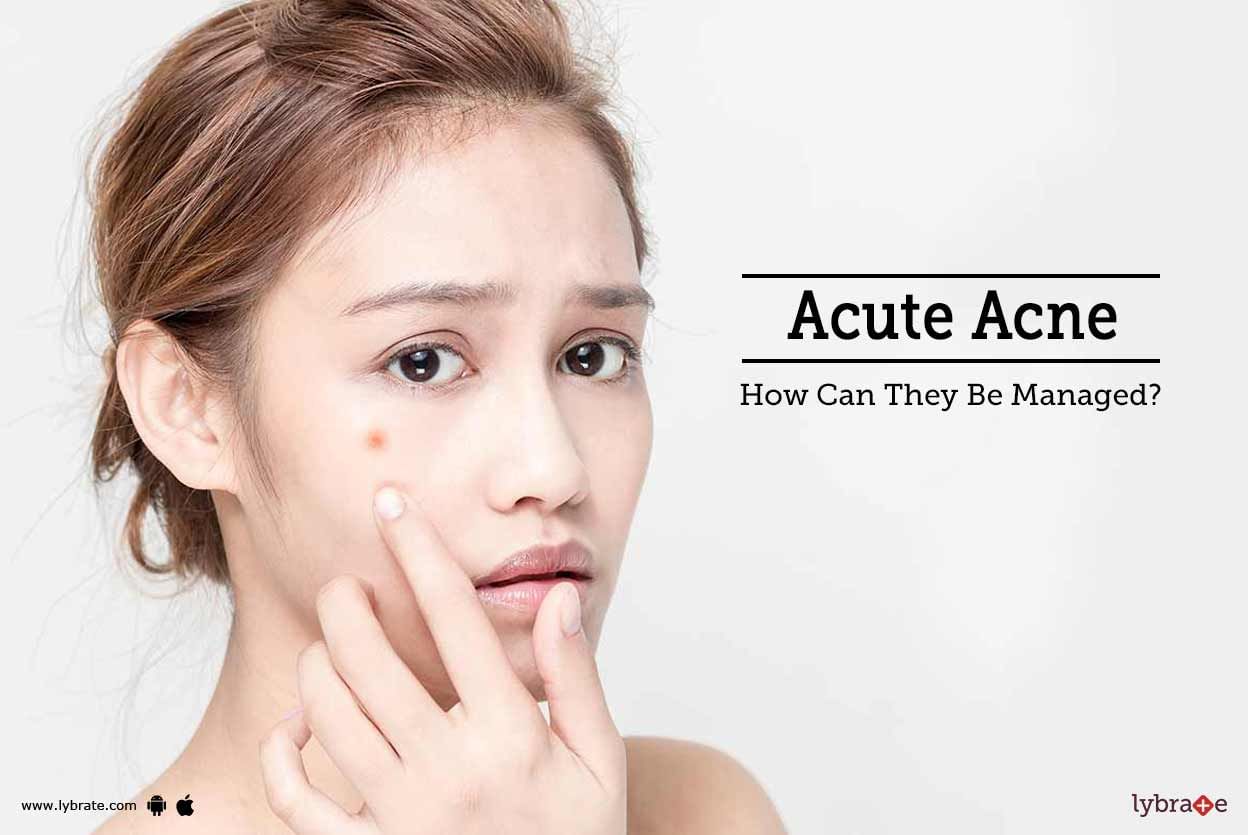 Acute Acne - How Can They Be Managed?