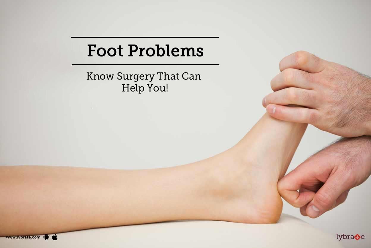 Foot Problems - Know Surgery That Can Help You!