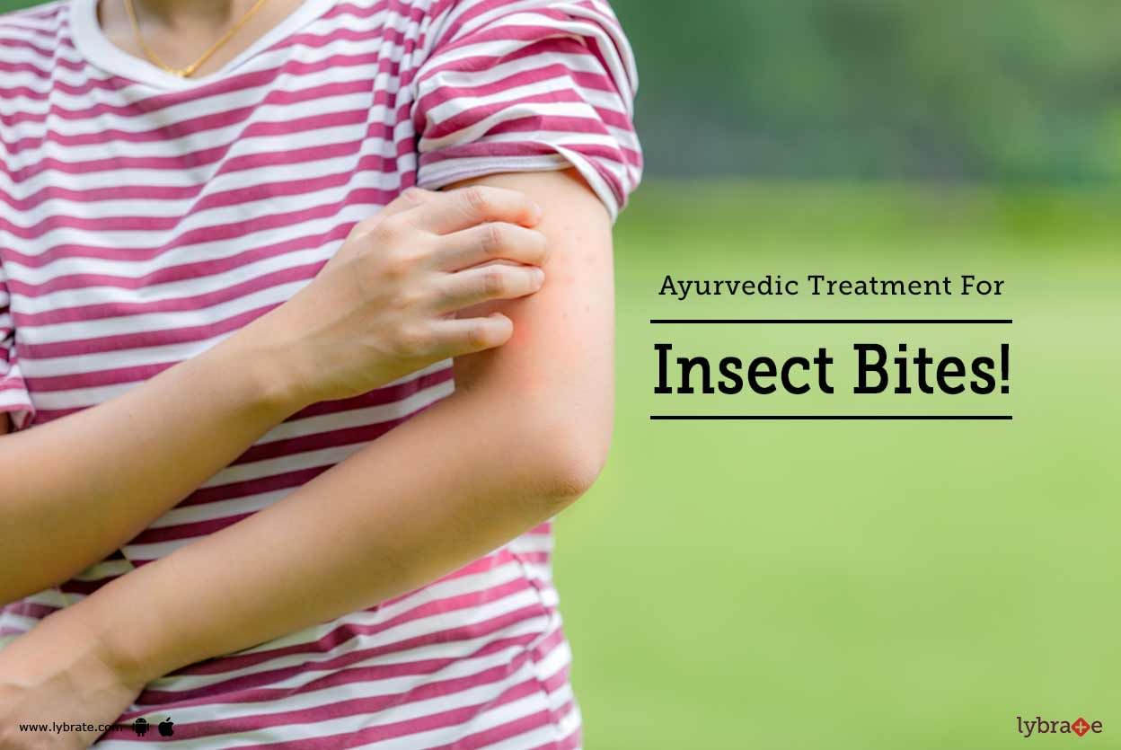 Ayurvedic Treatment For Insect Bites!