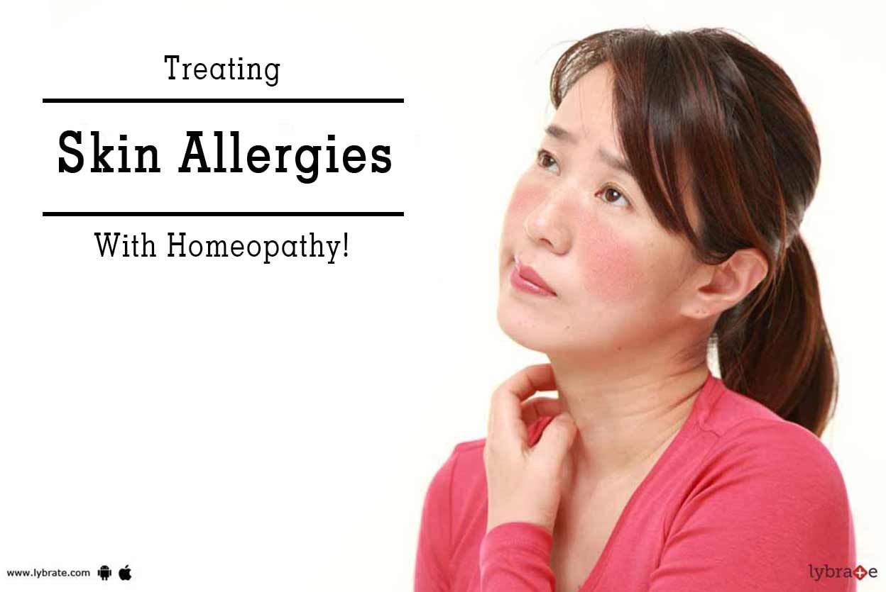 Treating Skin Allergies With Homeopathy!