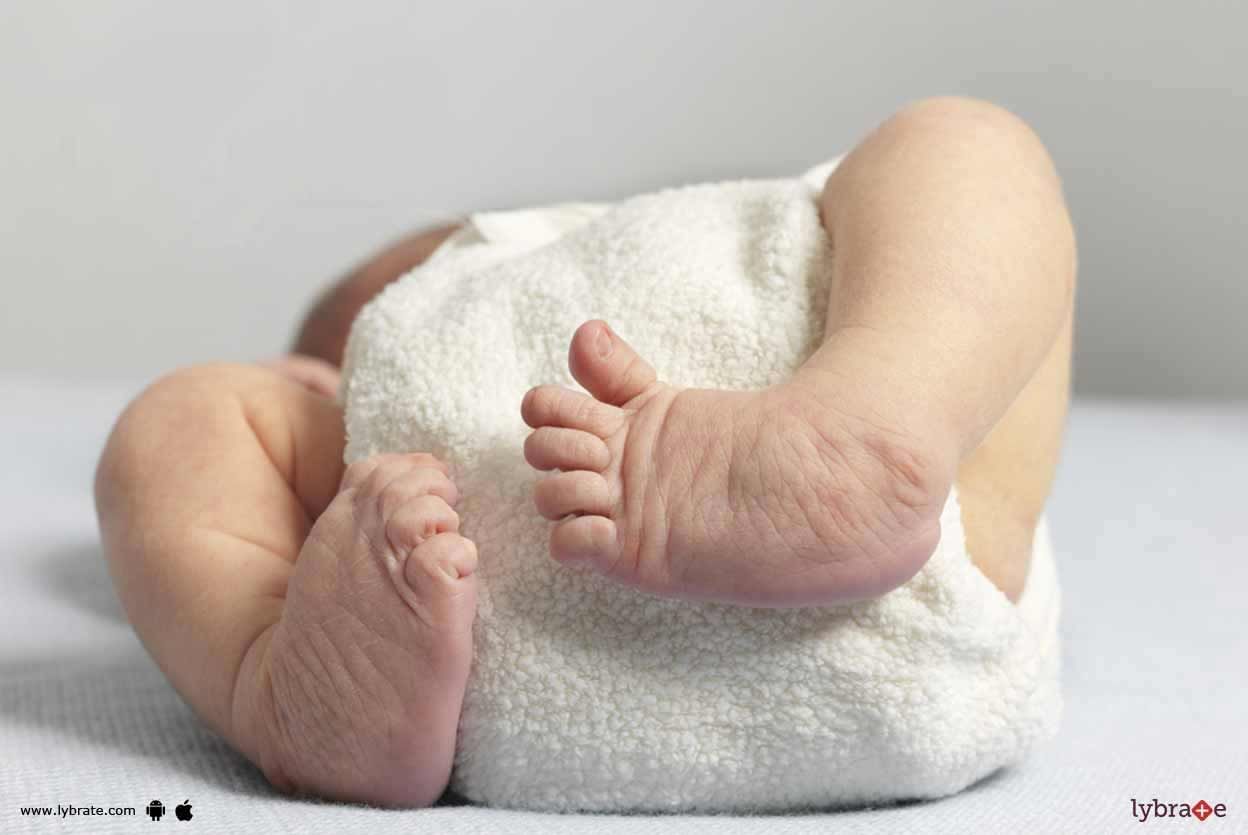 Clubfoot - How To Get Rid Of It?