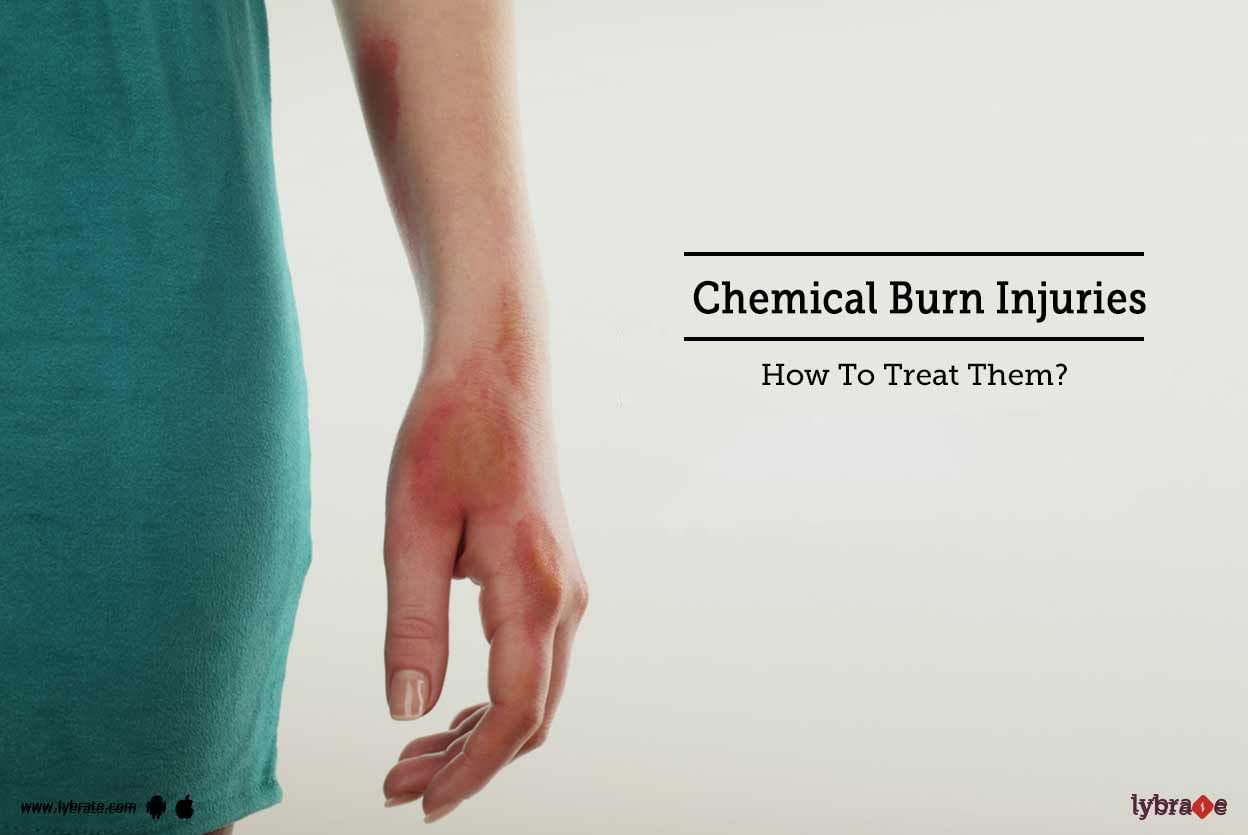 Chemical Burn Injuries - How To Treat Them?