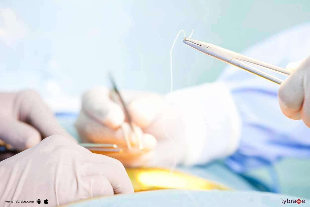 Minimally Invasive Spine Surgery - What Should You Know?