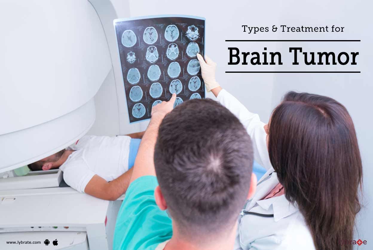 Types & Treatment for Brain Tumor