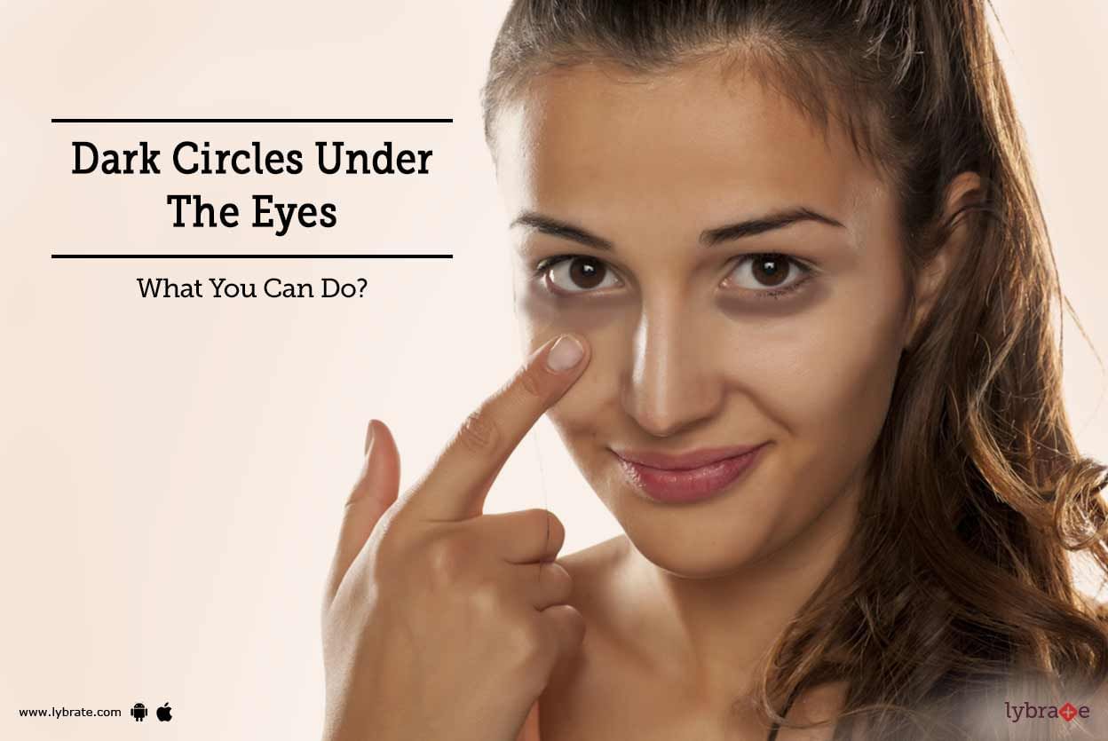 Dark Circles Under The Eyes - What You Can Do?