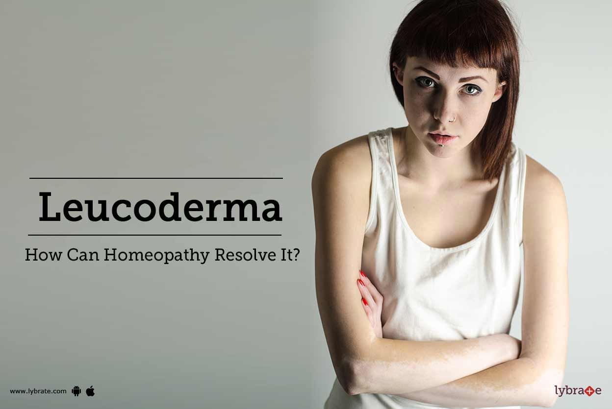Leucoderma - How Can Homeopathy Resolve It?
